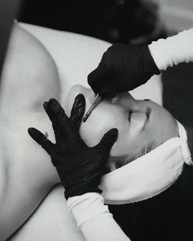 DERMAPLANE FACIAL