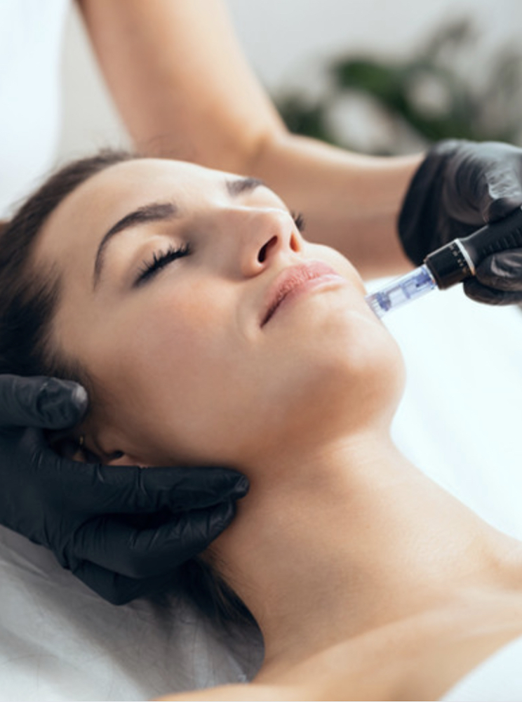 Microneedling