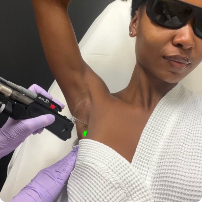 Laser Hair Removal Consult at Corrective treatments + professional skincare in Atlanta, GA