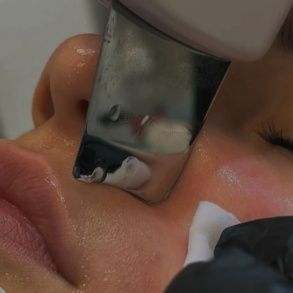 The Teen Glow Facial at Glow by Allison in Grapevine, TX