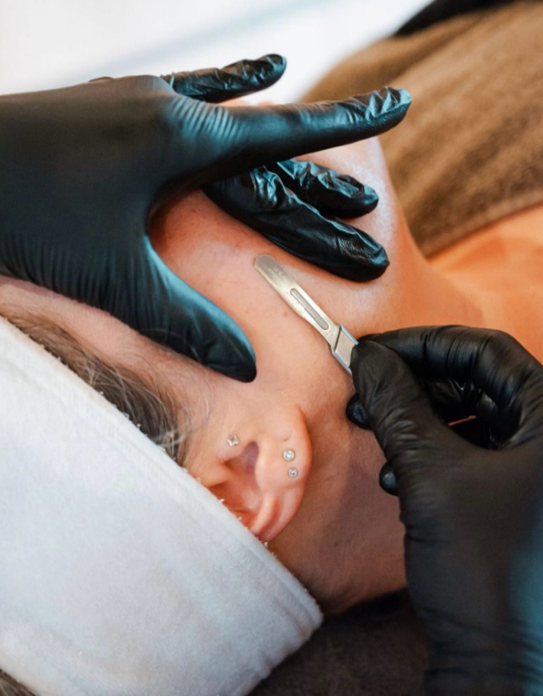 Dermaplaning at Ellie Esthetics LLC in Hurlock, MD