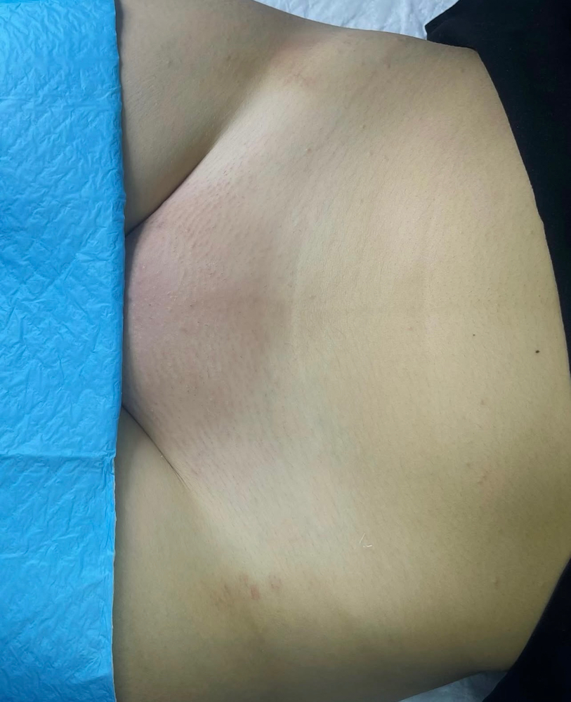 Brazilian Wax