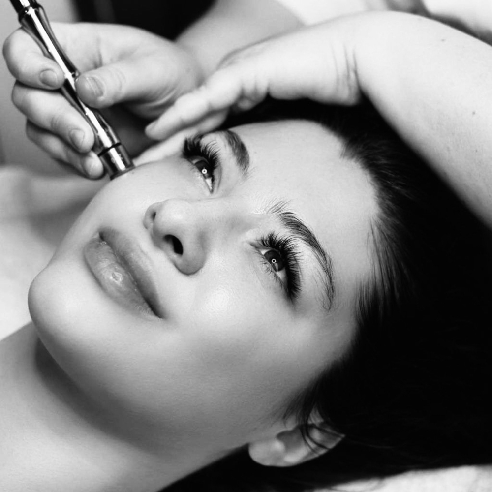 MICRODERMABRAISION ADD ON