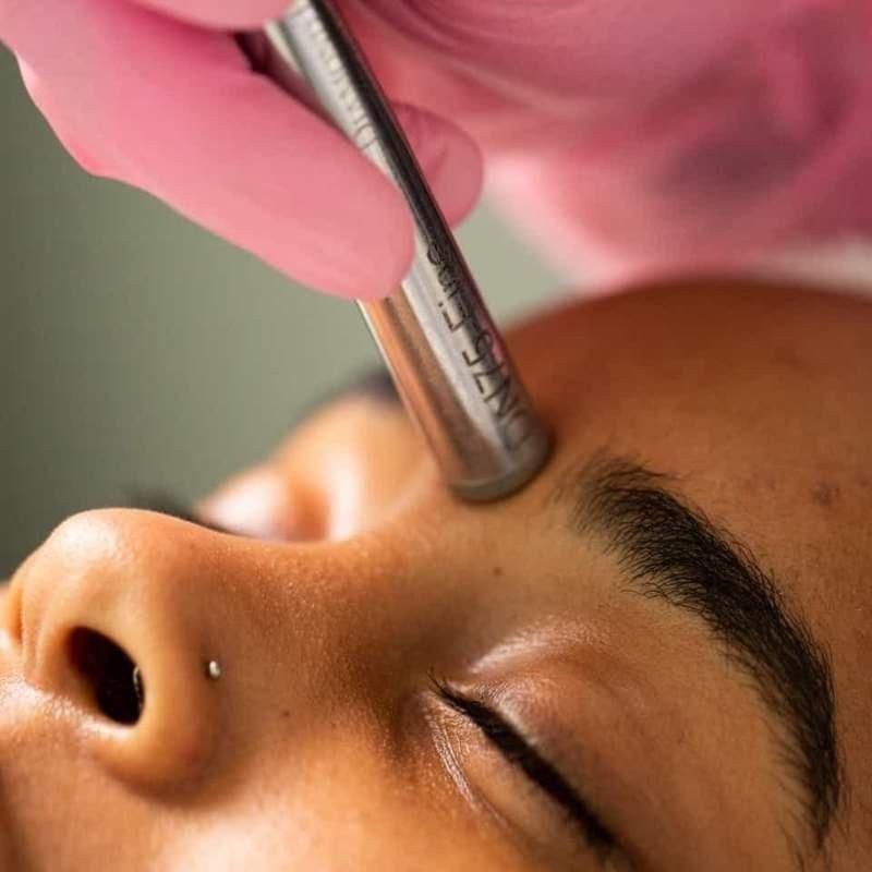 Microdermabrasion Boost at Luxe Royale Spa in Paramus, NJ