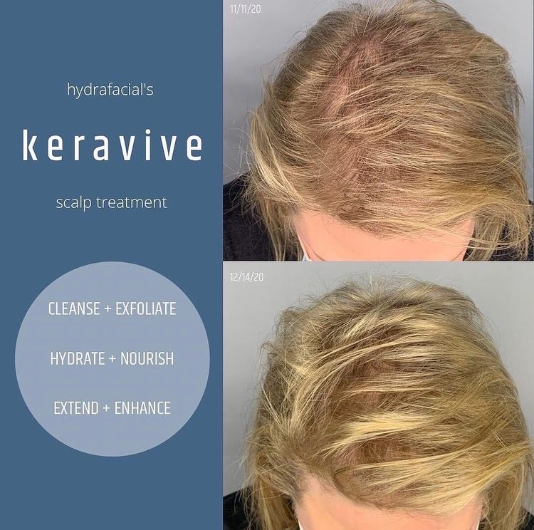 Keravive Hair Treatment Bundle