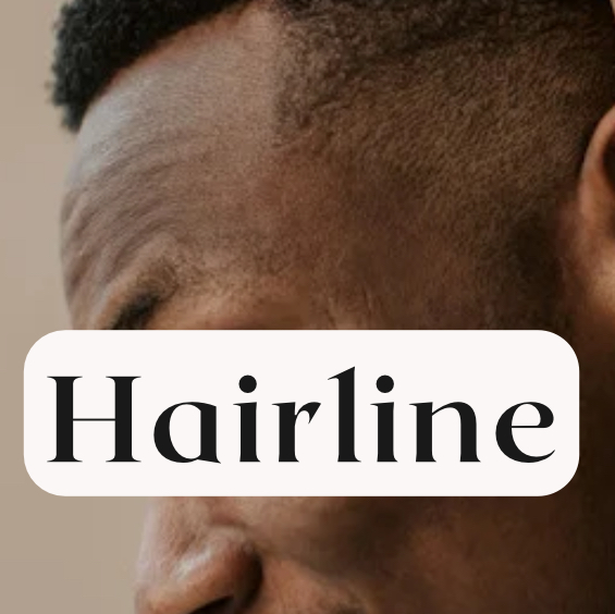 Men Hairline • Scalp Micro-pigment