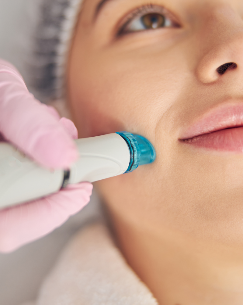 Hydrodermabrasion