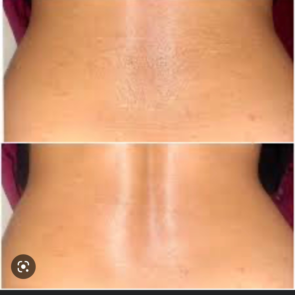 Lower Back
