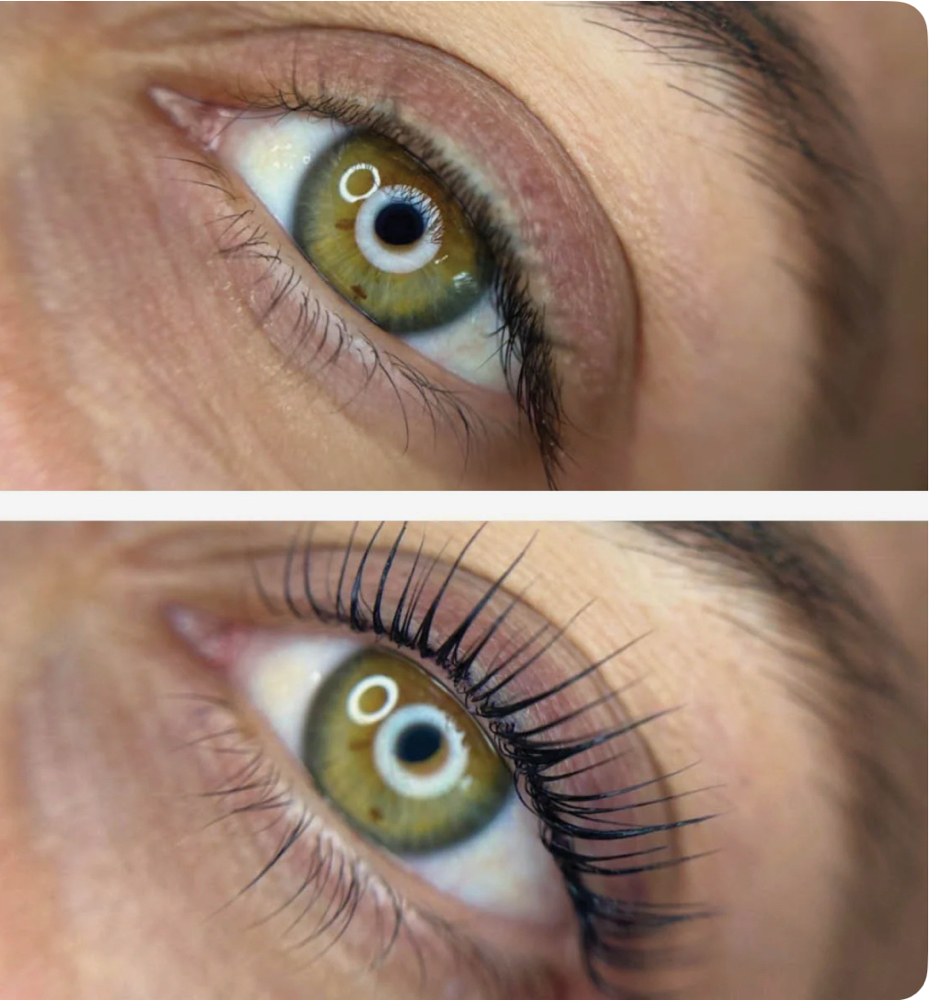 Lash Lift