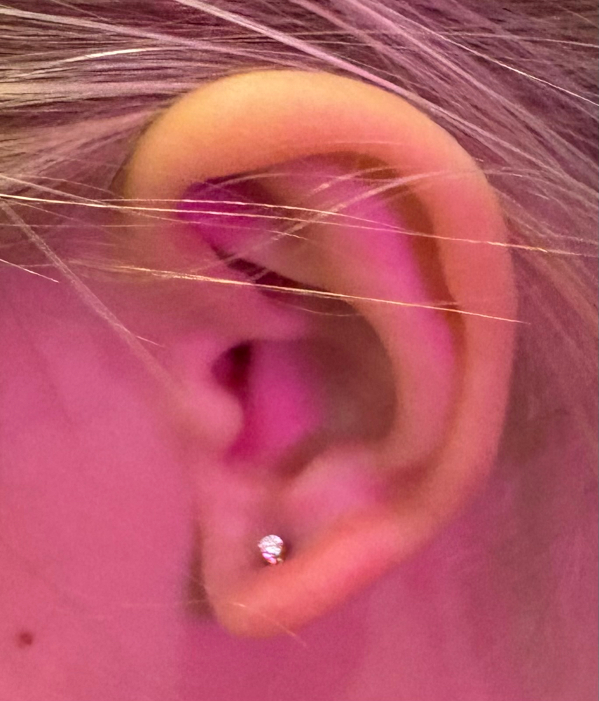 Childrens Earlobes Both Ages 5-17