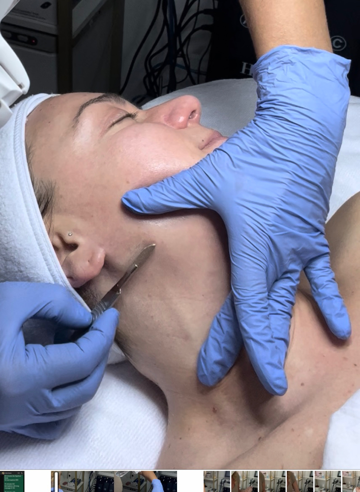 Express Dermaplane