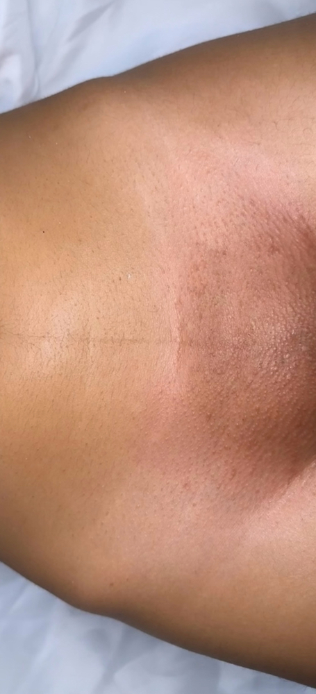 Brazilian Wax
