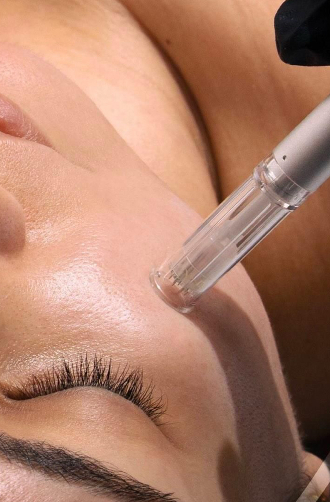 Nano-infusion Facial