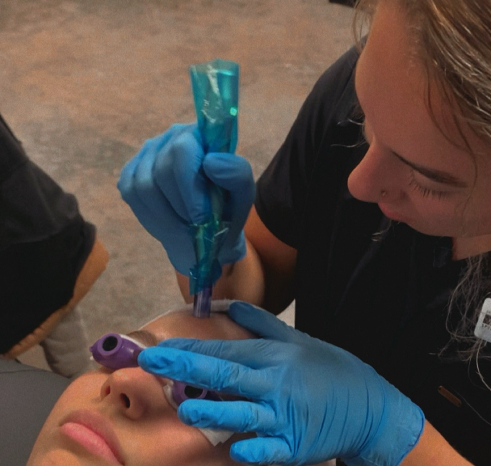 Microneedle Facial