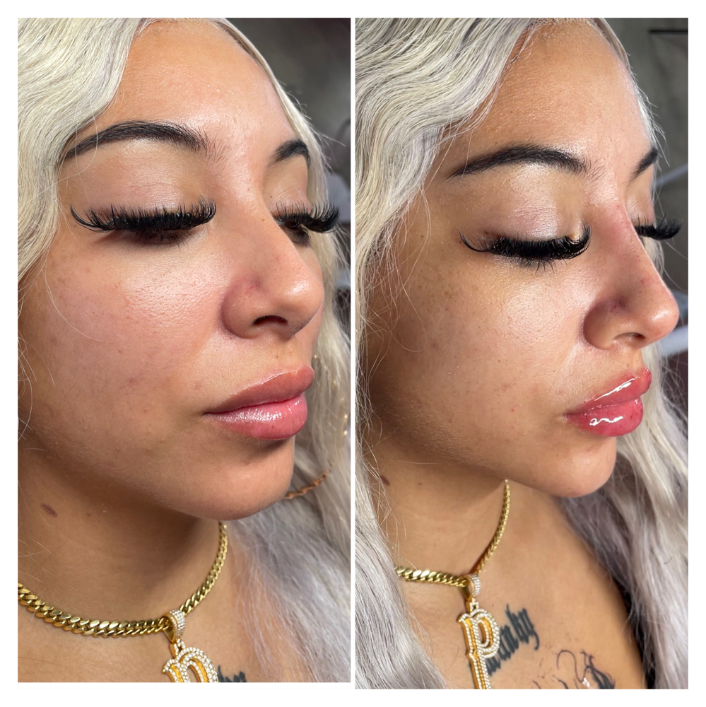 Facial Balancing Combo
