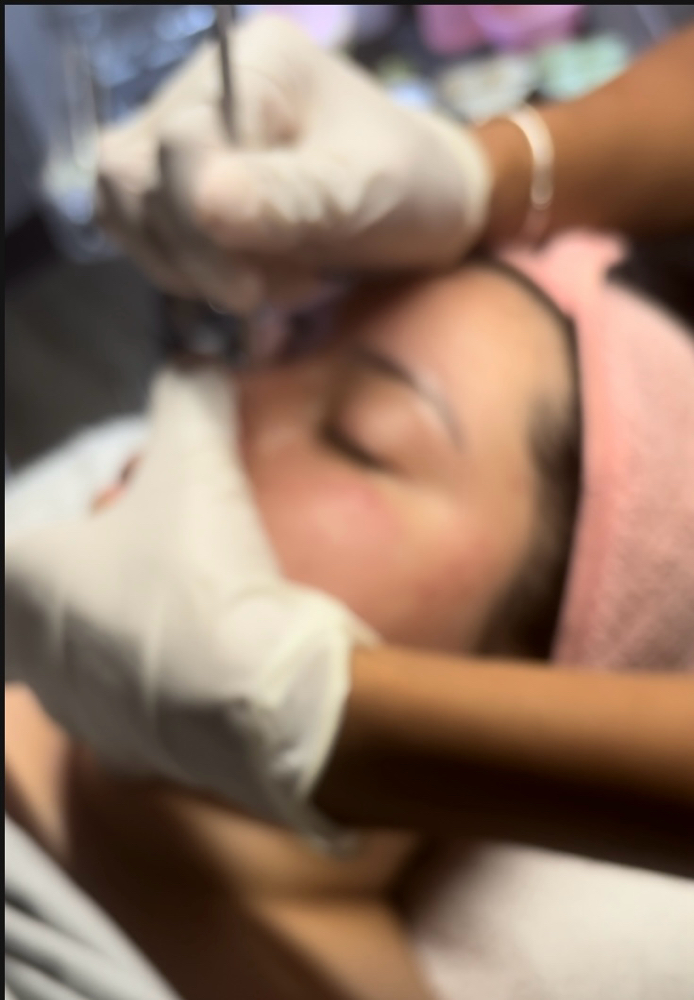 Dermaplaning Facial