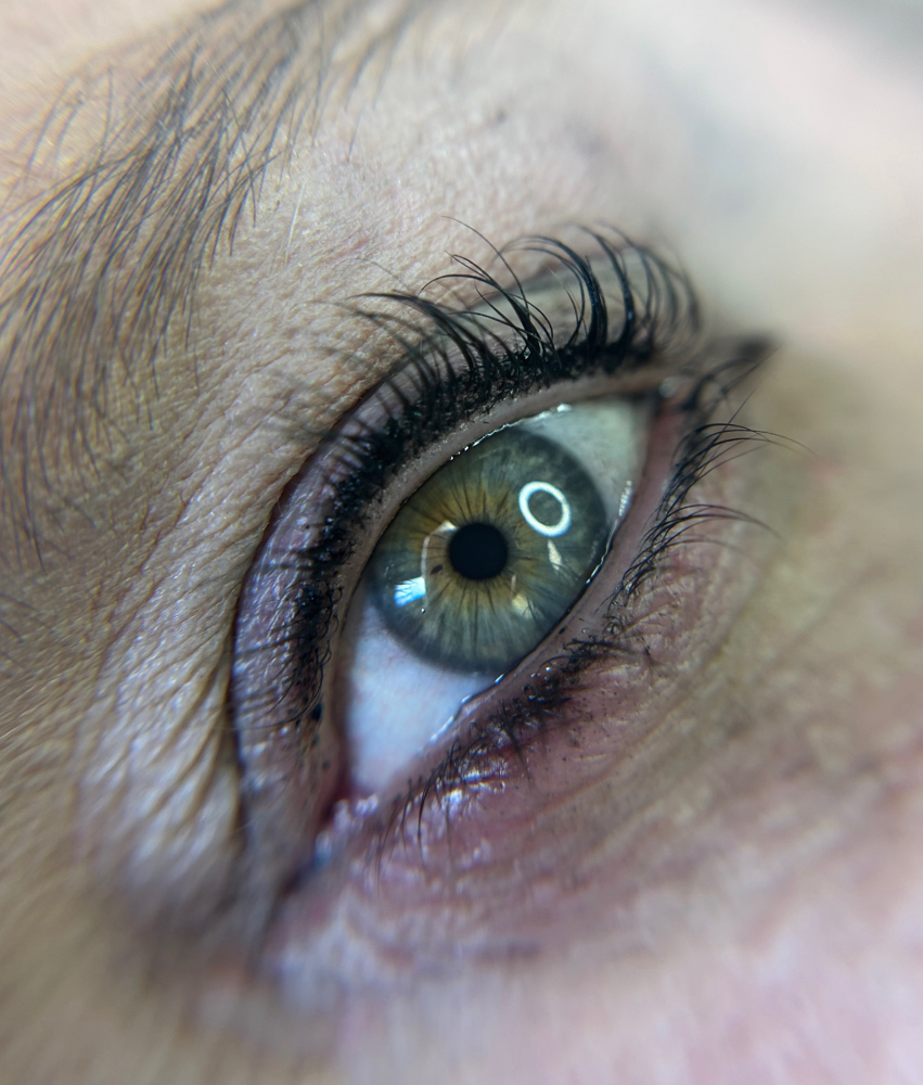 Lash Enhancement