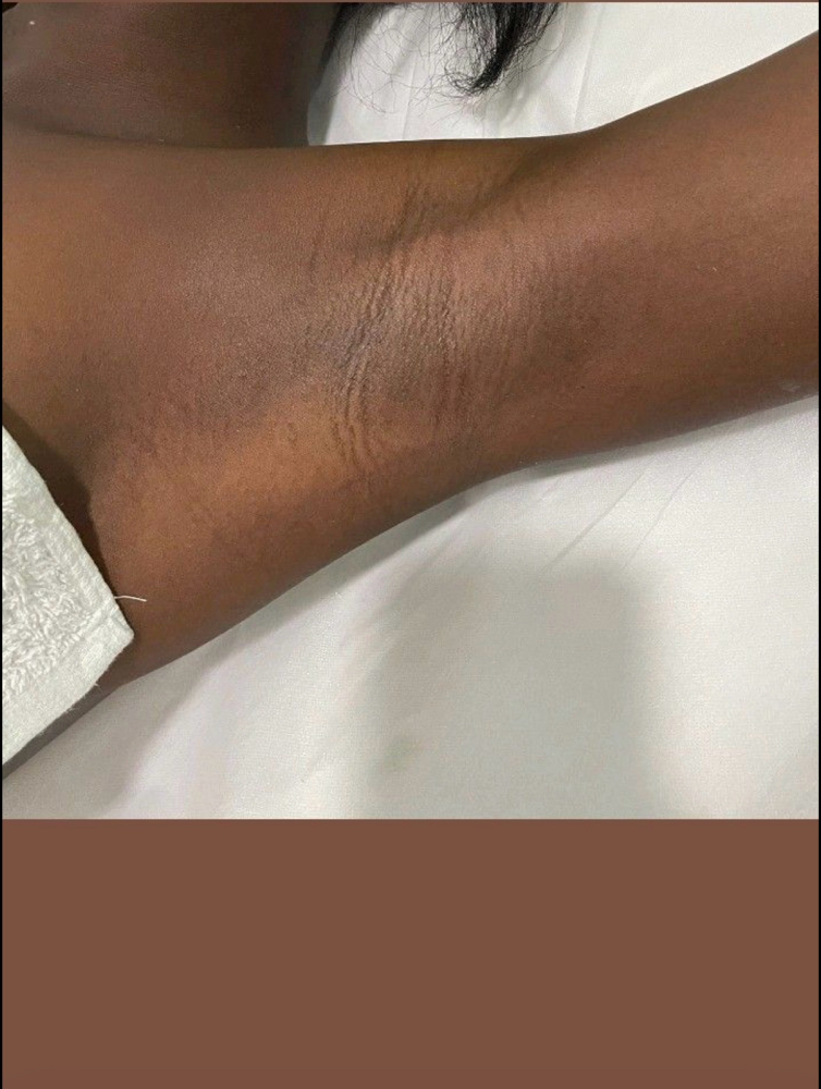Underarm Wax