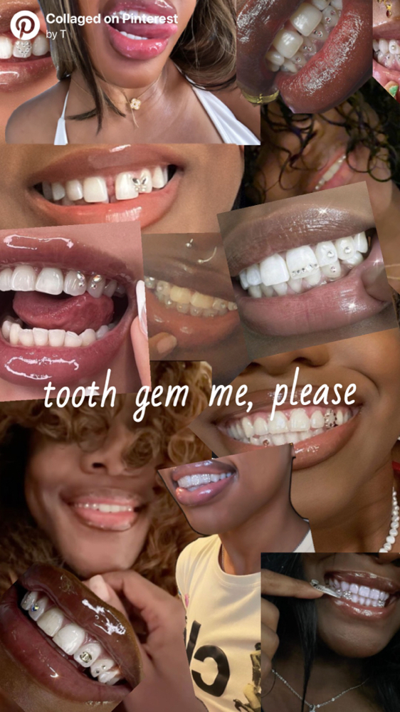 Tooth Gems