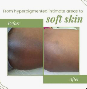 PCA Bright Body Peel