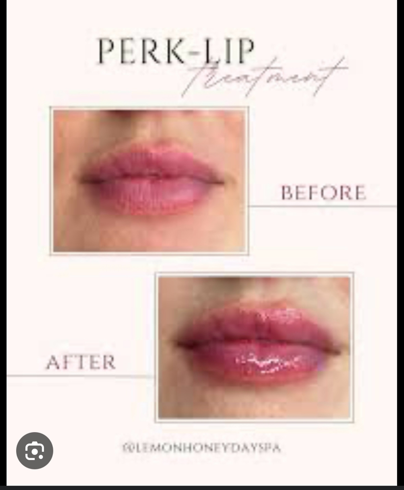 Hydrafacial Perk Lips Treatment at Merry Spa in Huntington, NY