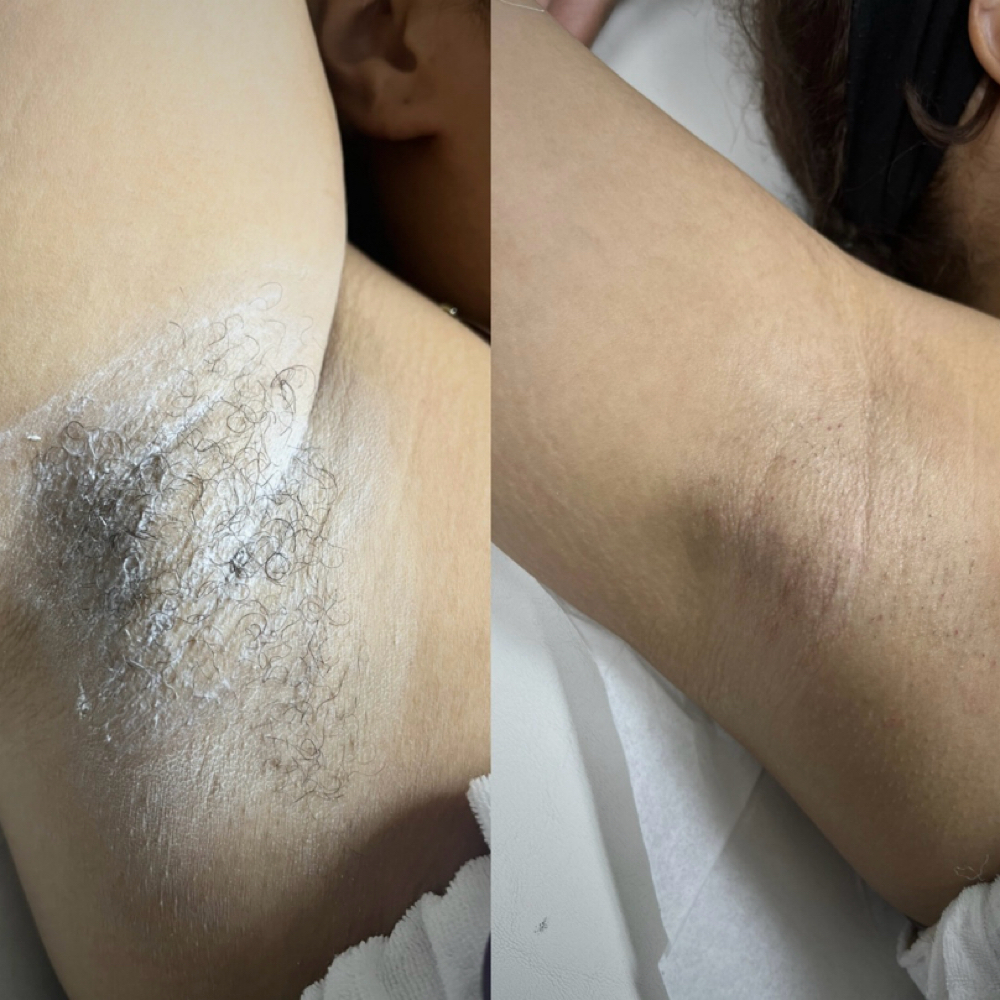 Underarms Wax at Mariangelie  Perales
