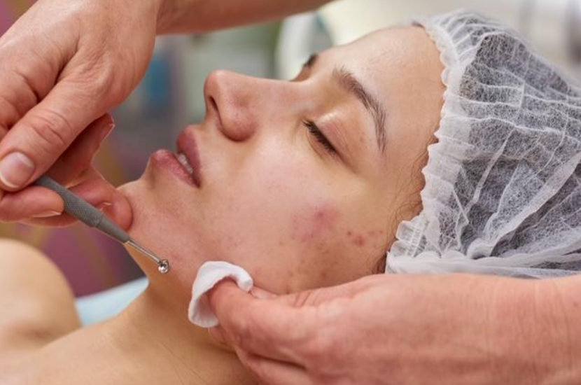 Clear Skin Acne Facial