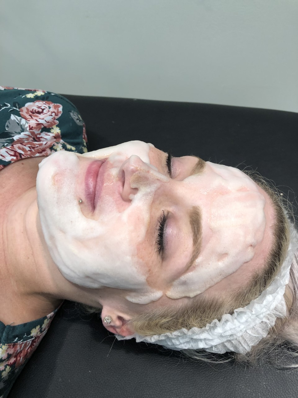 Oxygen Facial Treatment