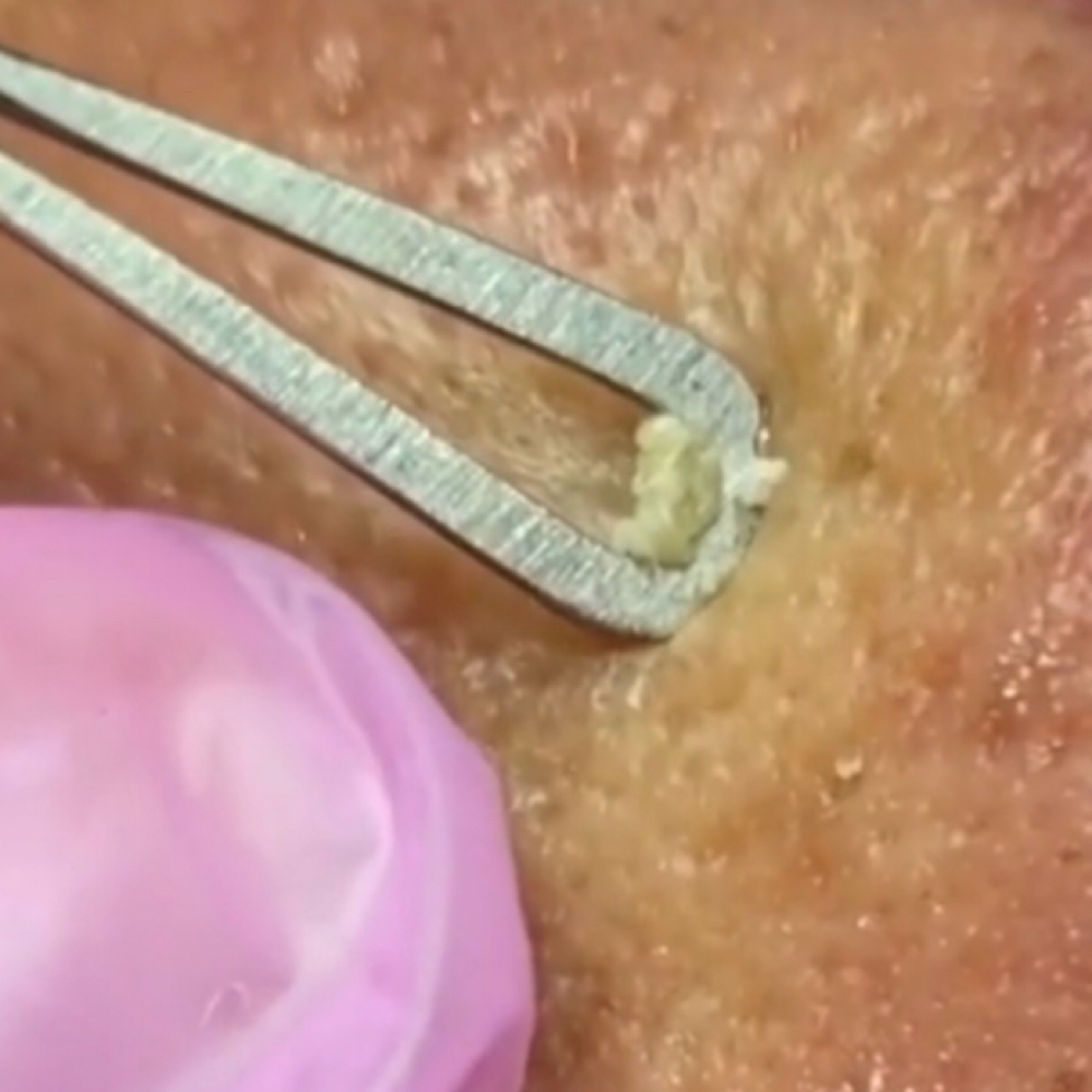 Detox Facial at Sweet Dreams Spa in Bronx, NY