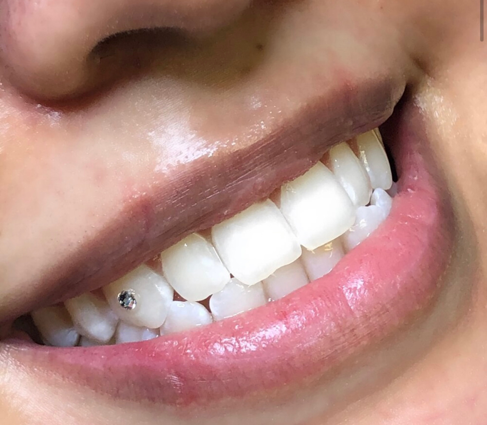 1 SWAROVSKI Tooth Gem