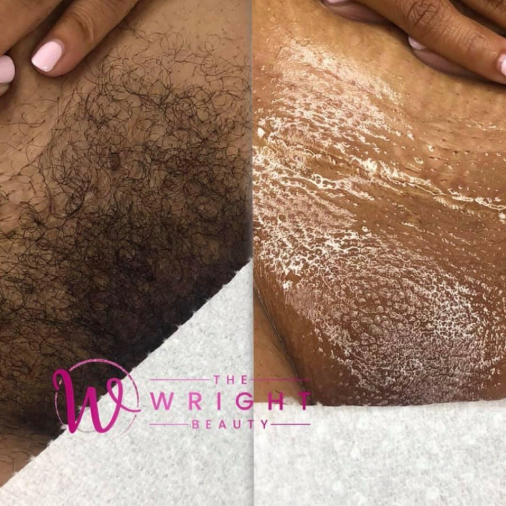 Brazilian & Underarm Wax Combo