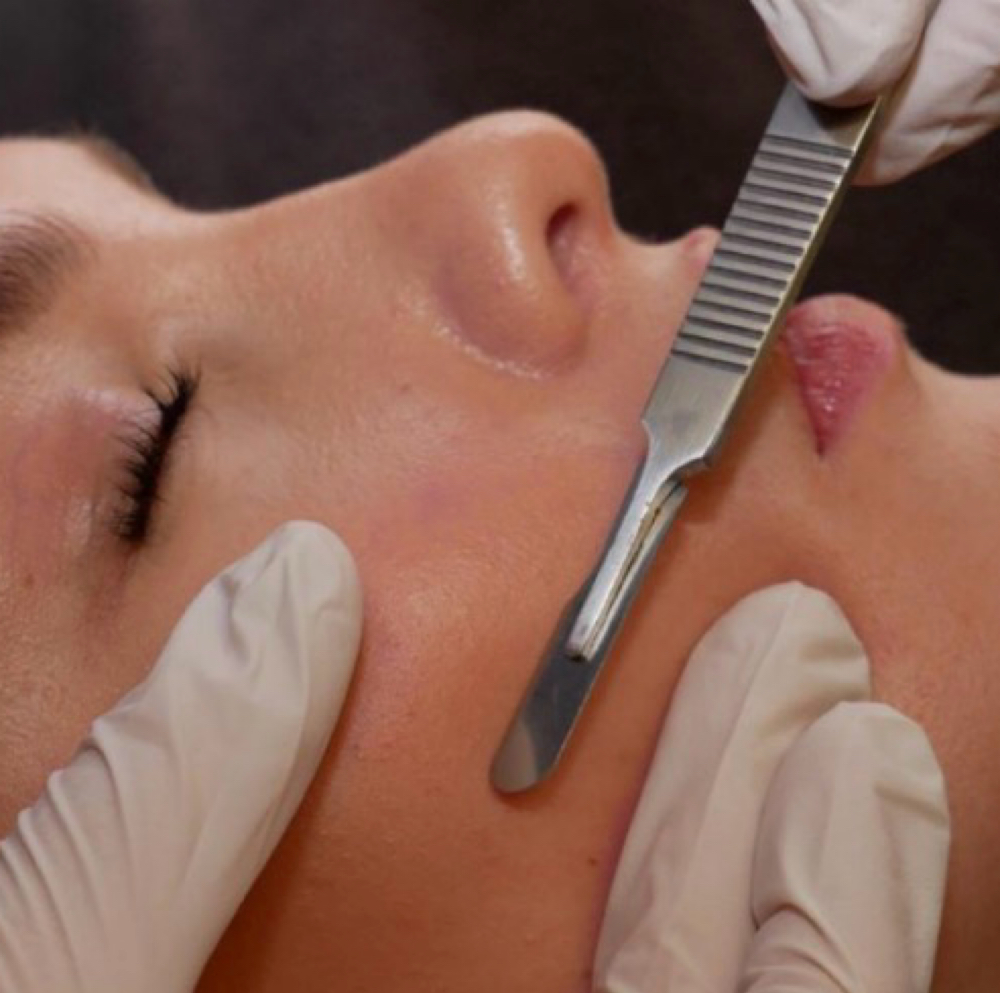Glass Skin Dermaplane Facial at Restored Glow Aesthetics in Whitehouse Station, NJ