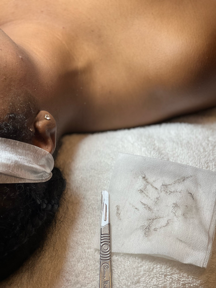 Dermaplane
