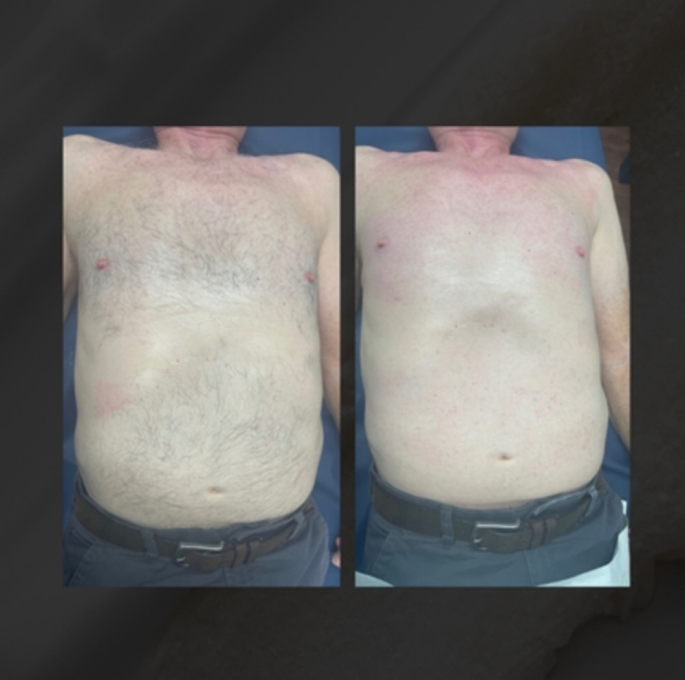 MEN - Full Chest at Madam Wax in Nashville, TN