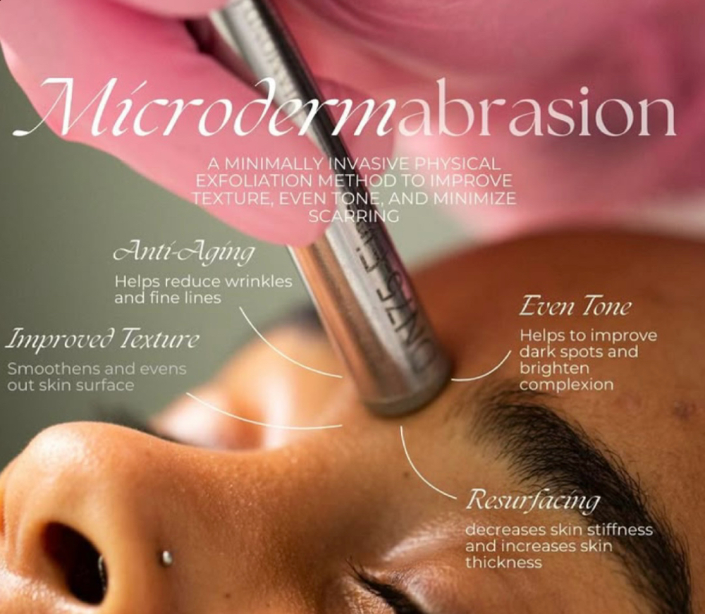 Microdermabrasion Facial (Lynbrook)
