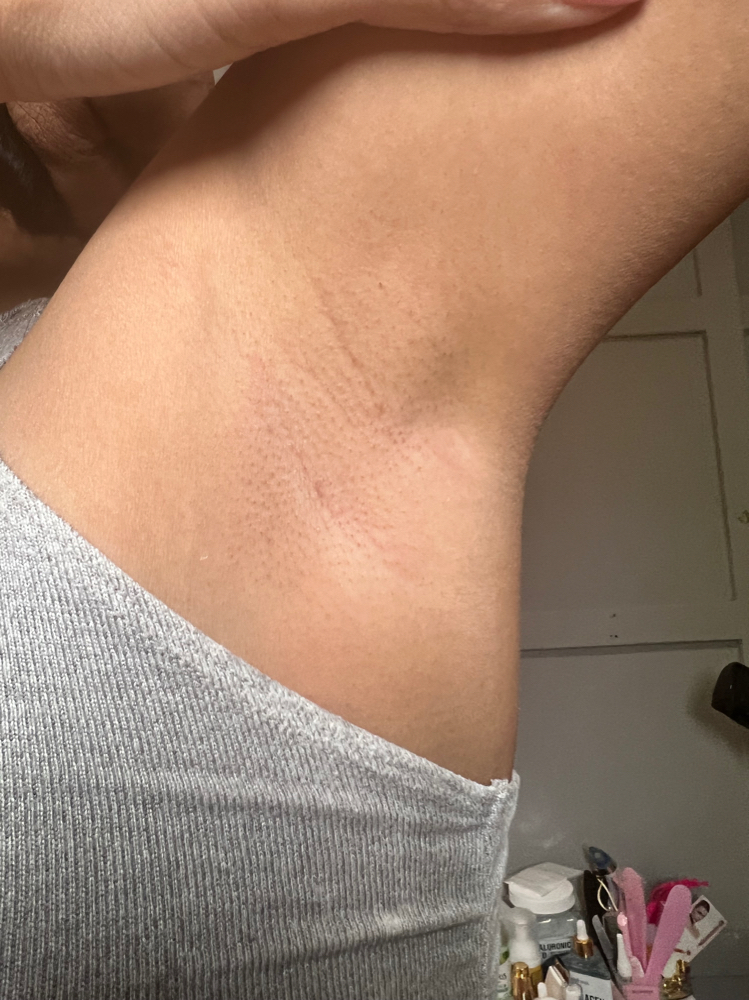 Underarm Wax