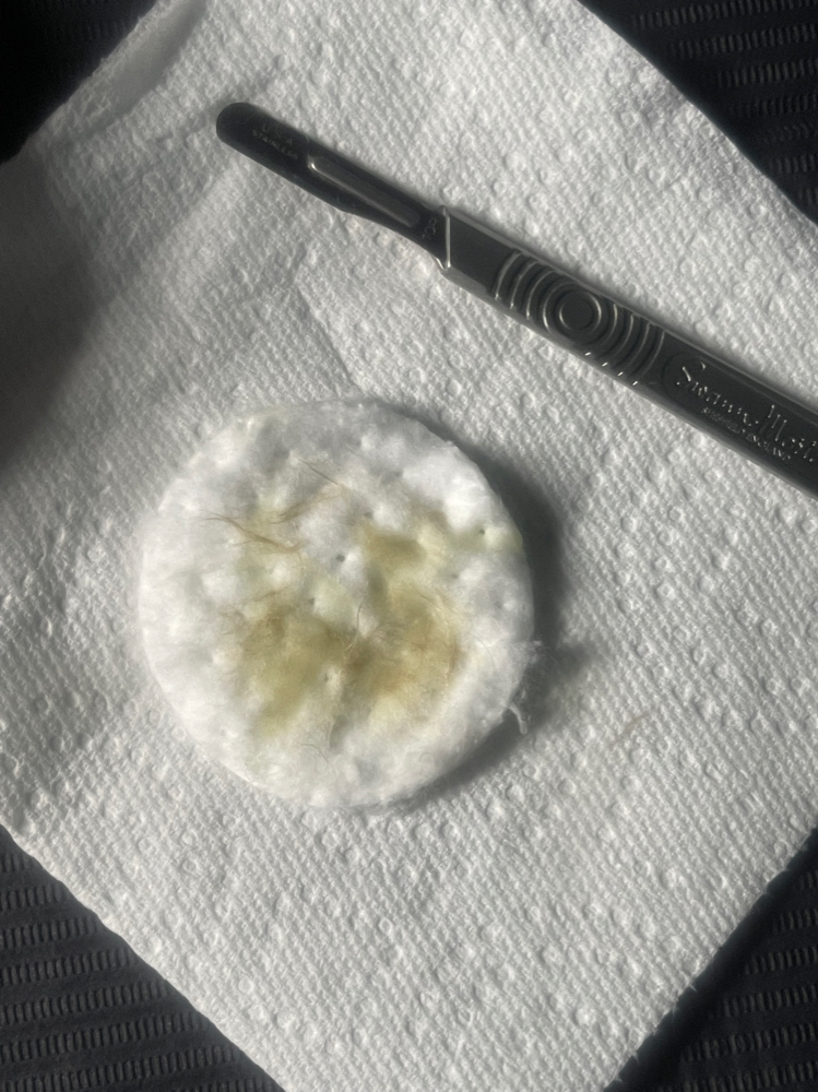 Dermaplaning Facial