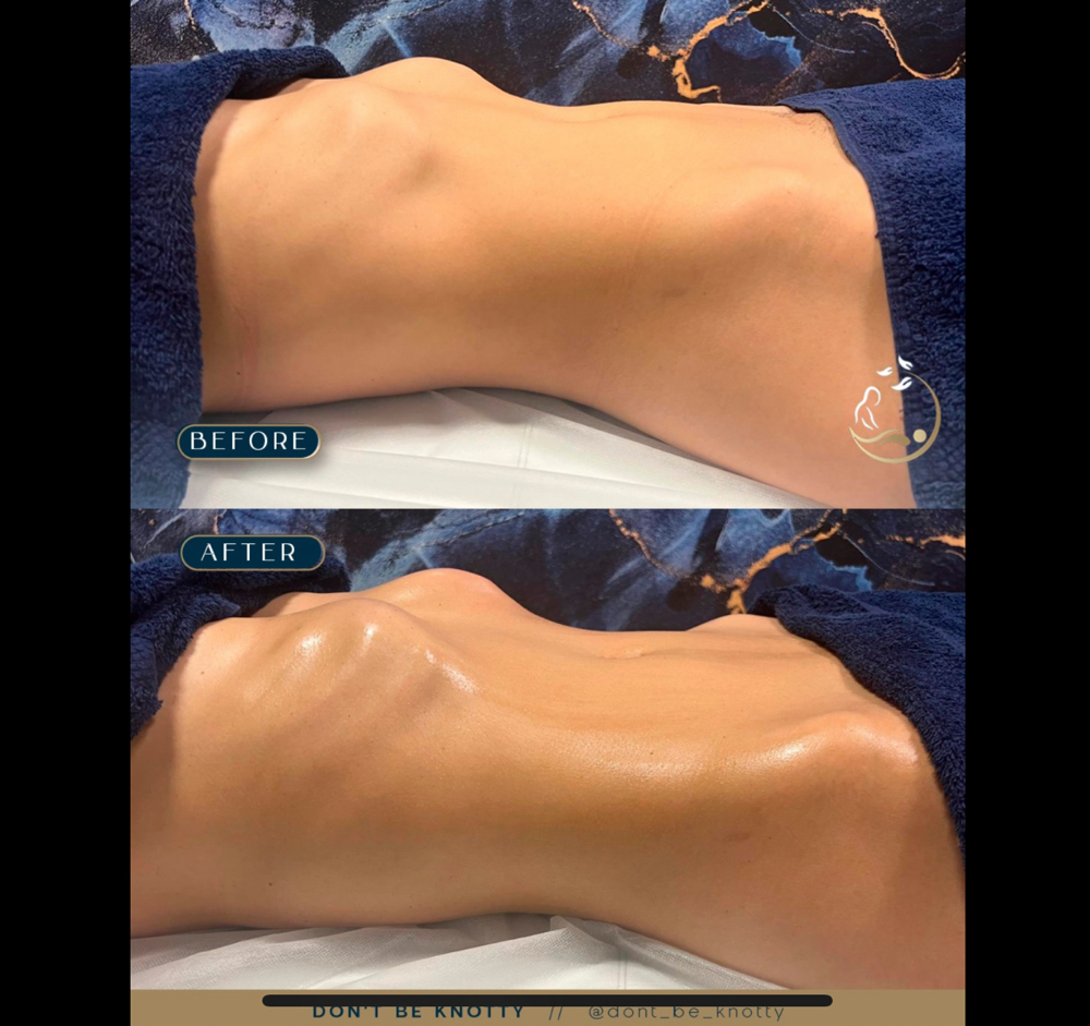 Braziliam Lymphatic Massage