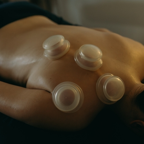 Cupping