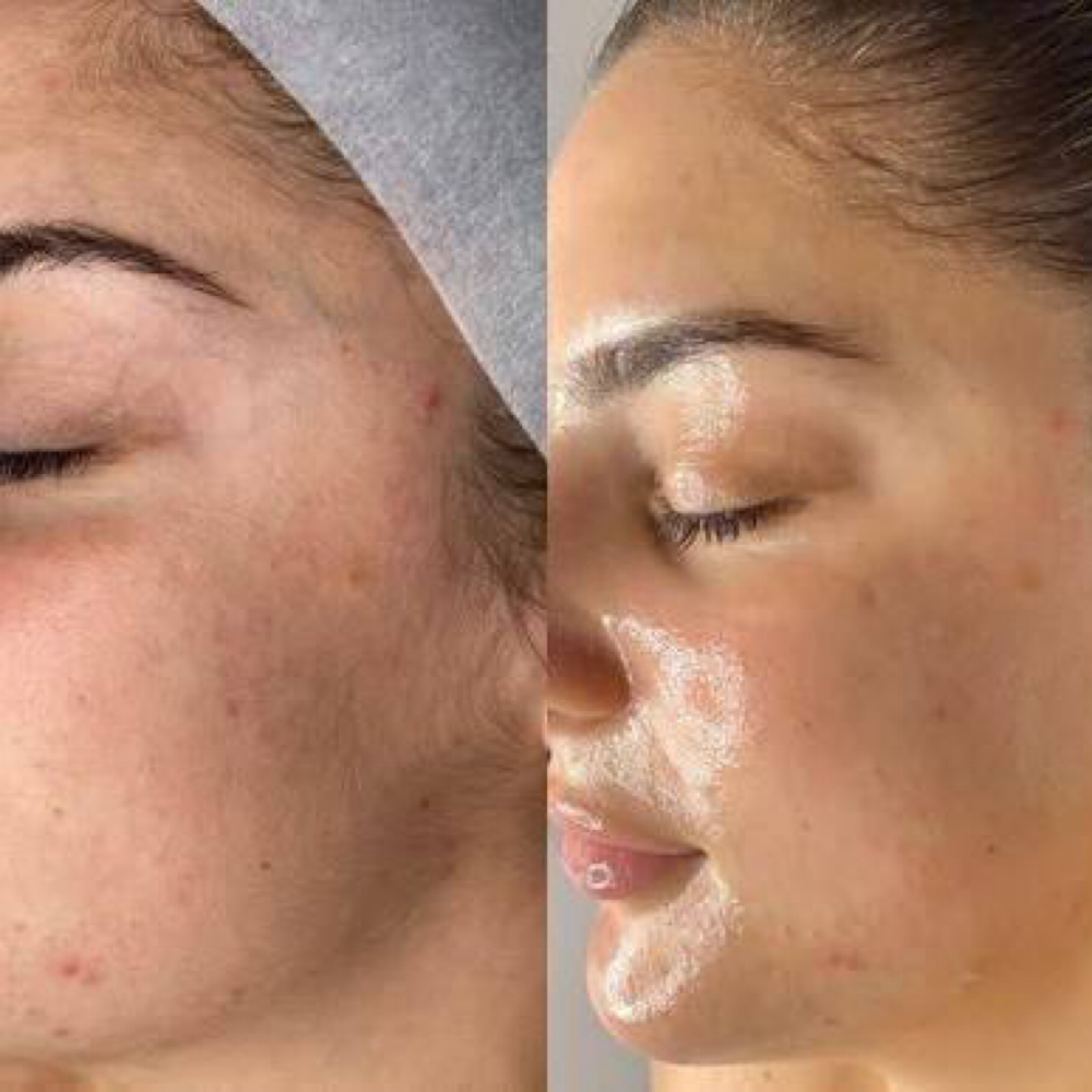 Custom Organic Facial