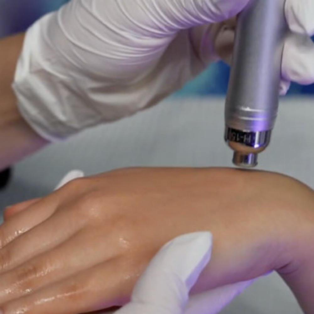 HydroDiamond™  Hand Restoration at TAYLUXE ESTHETICS in Charlotte, NC