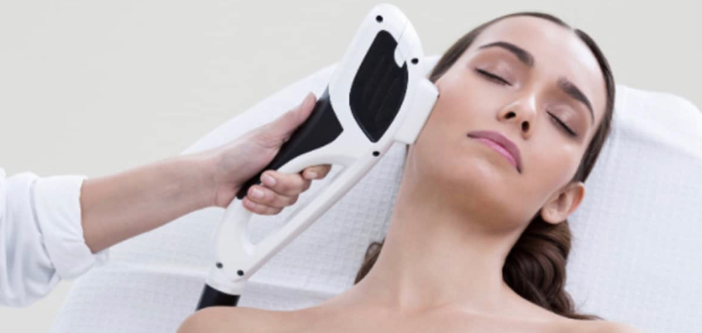 IPL Photofacial