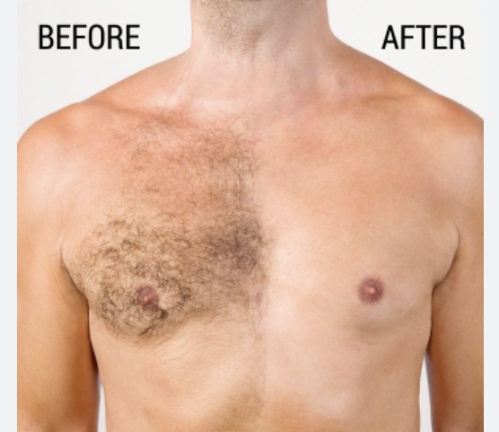 Chest Wax