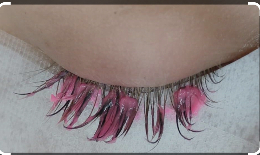Lash Removal