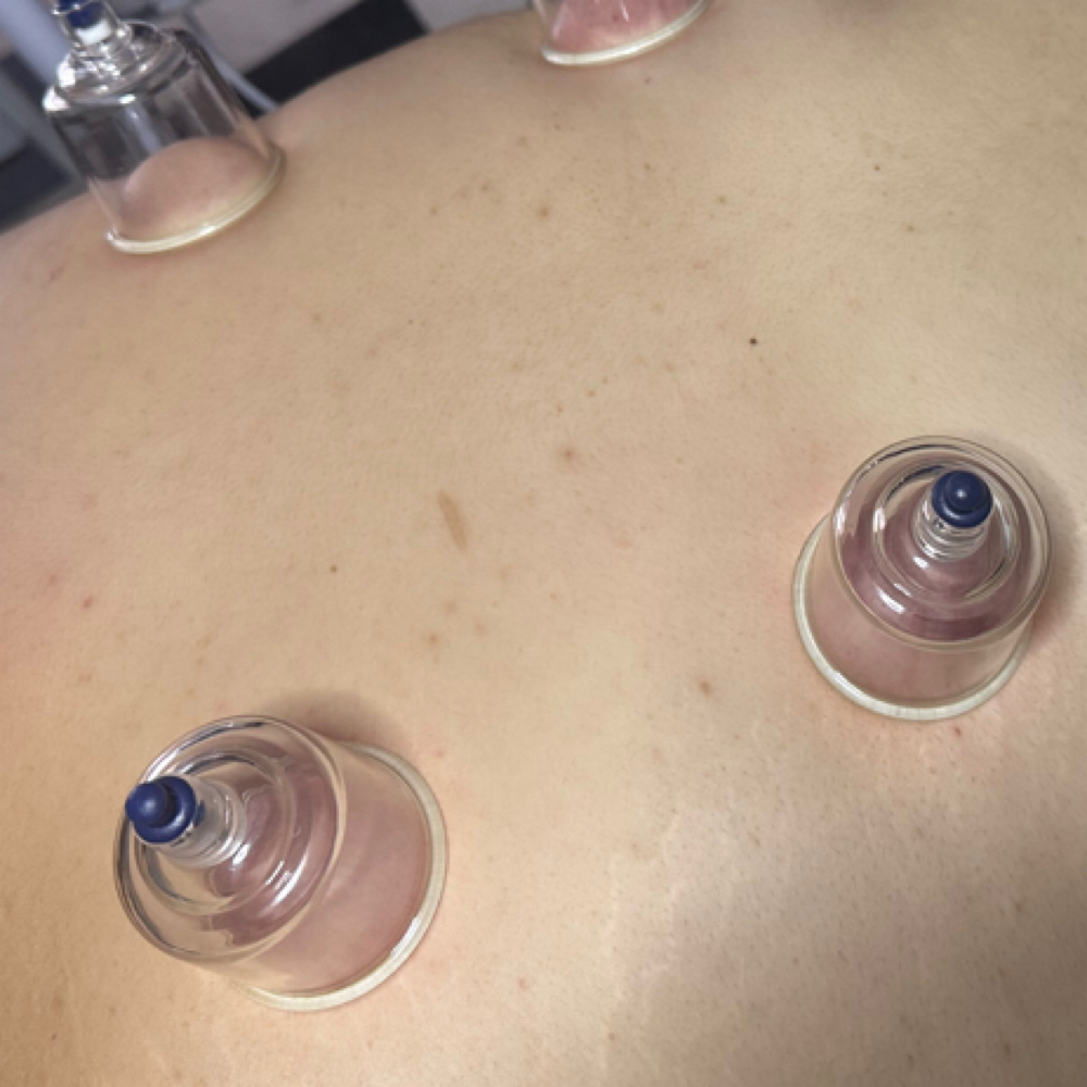 Rooted Recovery Back Treatment at Rooted Studio in Manchester, CT