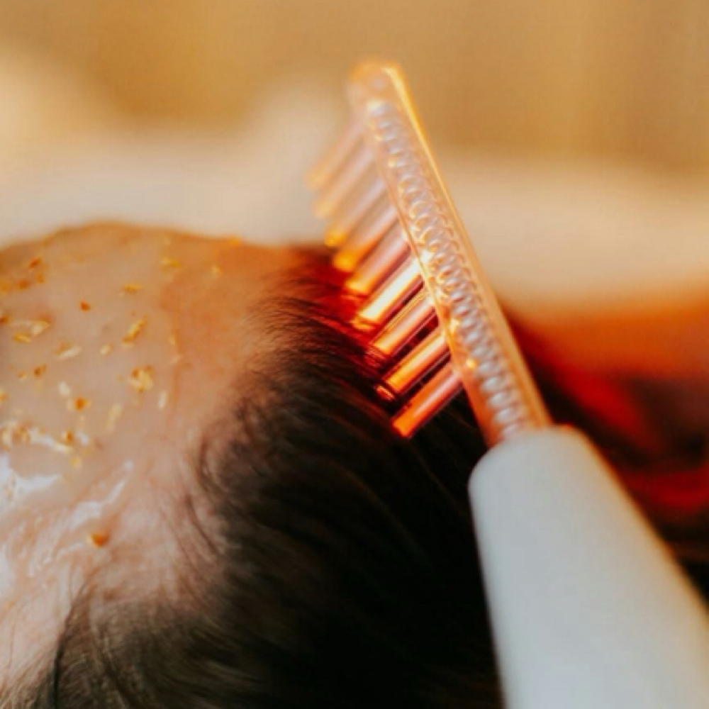 High Frequency Comb Scalp Treatment
