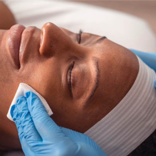 Taylor'd Renewal Peel