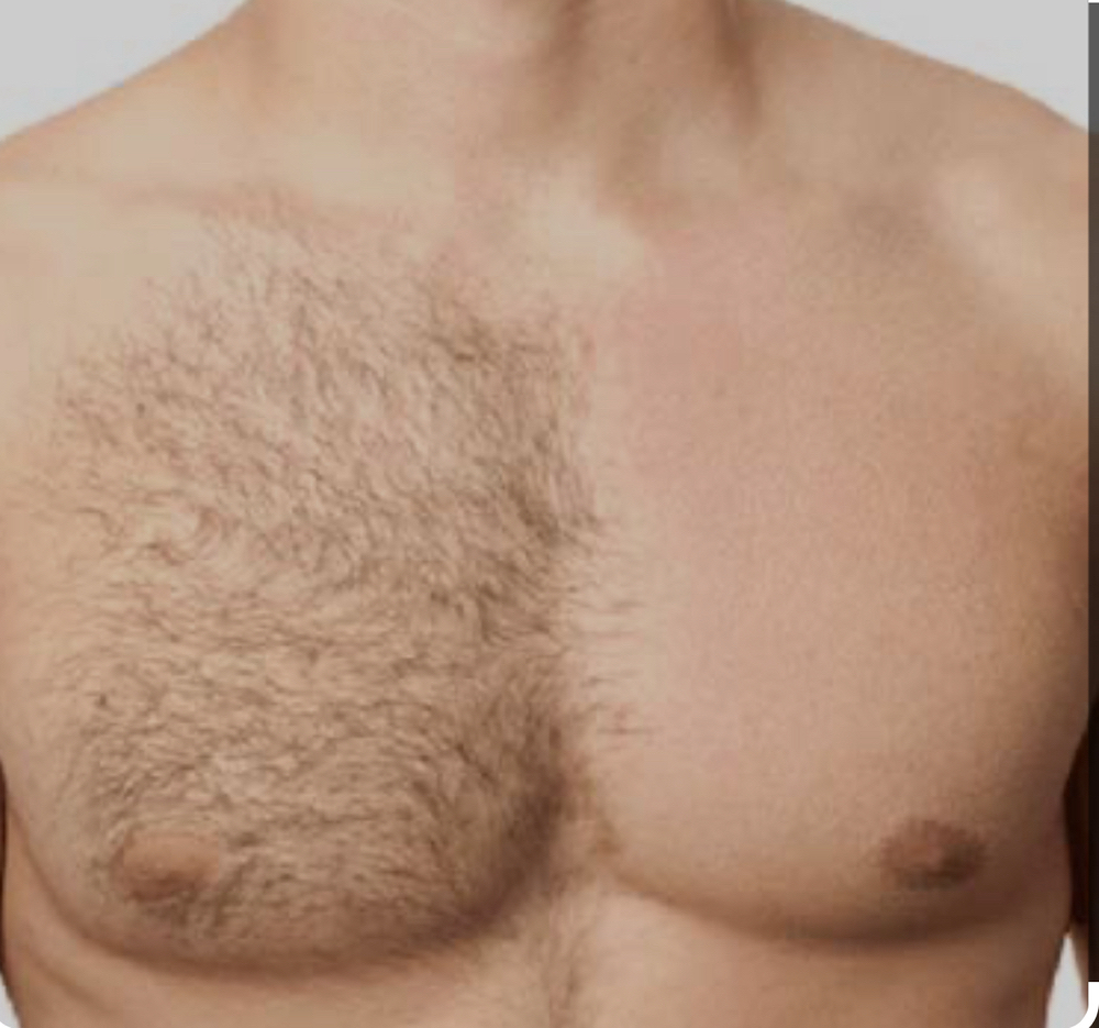 Male Chest Waxing