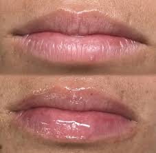 💋HydraGloss Lip Treatment- Add-On