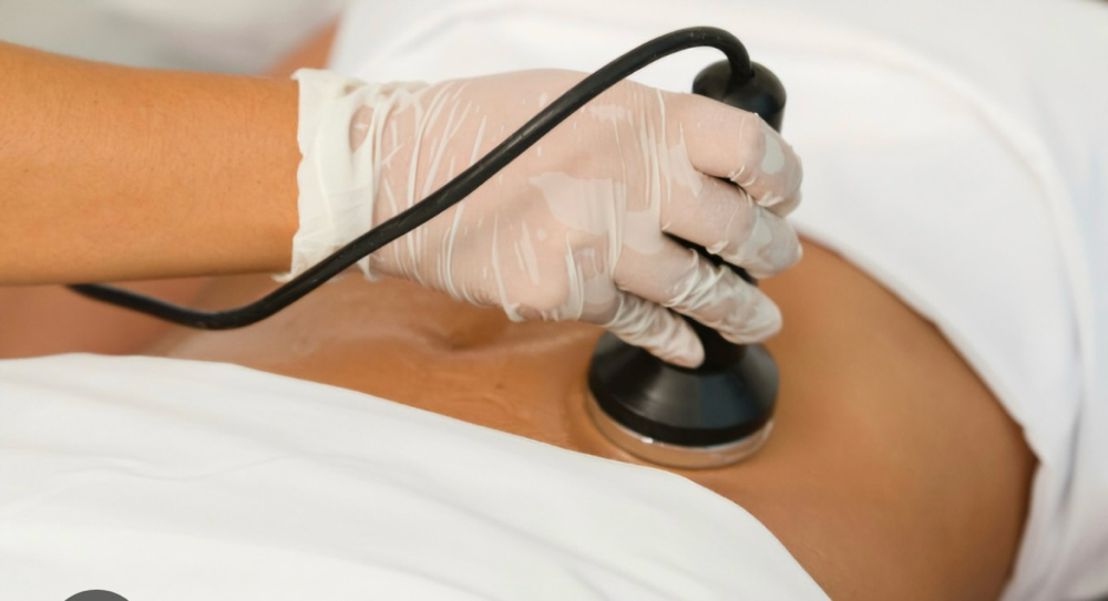 Ultrasonic Cavitation/RF